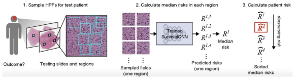 뇌종양 환자 조직의 면역염색 이미징 기반의 예후예측 모델 (Mobadersany et al, PNAS 2018)
