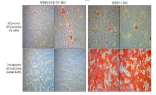 (왼) AA 환자 MSC 분화, (오) 정상공여자의 MSC 분화