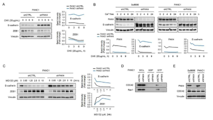PAK4 knockdown이 E-cadherin 발현 증가 조절 기전 실험