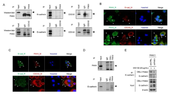 PAK4, E-cadherin, CDC42 상호결합과 E3 ubiquitin-ligase Hakai 작용 평가