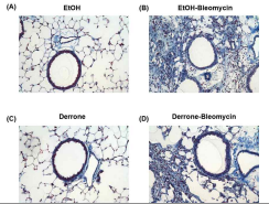 Bleomycin 유도 폐 섬유화 마우스 모 델에서 derrone 처리 여부에 따른 폐 손상 조직 등의 염증 반응 및 폐 조직의 손상 변화를 확인