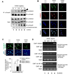 Smad3/HDAC2 복합체가 NF-kB 활성화를 억제