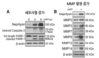 혈관평활근 세포에 Neprilysin 과 발현에 의해 증가하는 (A) 세포사멸 소견과 (B) MMP 효소의 발현 증가