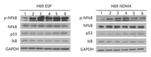 ESP 및 (NDMA 처리 시 나타나는 염증, 발암 관련 단백 질의 발현 변화 (좌) Lane 1~6. ESP(1.6ug/ml)처리 후 각 0, 3, 6, 9, 12, 24시간 경과 (우) Lane 1~6. NDMA(8ug/ml)처리 후 각 0, 3, 6, 9,12 24시간 경과