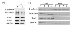분비배설물 처리시 EMT 및 섬유화 관련 단백질 의 발현 변화 (가)간 성상세포(LX2) Lane 1. 대조군 Lane 2. 분비배설 물(1.6ug/ml) 24시간 처리군 (나) 담관 상피세포(H69) 및 담관암세포(HuCCT1) Lane 1, 5. 대조군 Lane 2, 6. 분 비배설물((1.6ug/ml) 12시간 처리군) Lane 3, 7. 분비배 설물((1.6ug/ml) 24시간 처리군) Lane 4, 8. 분비배설물 ((1.6ug/ml) 48시간 처리군)