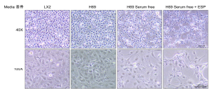 배양 배지 조건에 따른 LX2 세포의 형태