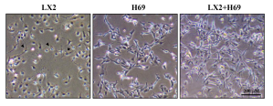 H69 배양 배지에서 공동배양한 H69 세포와 LX2 세포의 형태