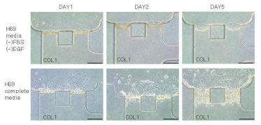 3차원 미세 유체 소자 내에서 H69 세포 배양액 조성변화에 따른 LX2 세포의 형태 (scale bar=20 um, magnification: 100x)
