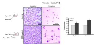Trans-well assay를 통한 공동배양 시 LX2 세포의 ESP 처리 유무에 따른 H69 세포의 이동 및 침투 변화