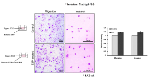 Trans-well assay를 통한 공동배양 시 H69 세포의 ESPs 처리 유무에 따른 LX2세포의 이동 및 침투 변화