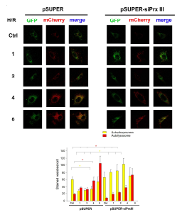 PrxIII 발현 억제 시, H/R에 의한 autophagy flux 억제
