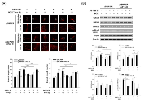 Prx III 재발현 시, doxorubicin에 의한 미토콘드리아 fragmenation 감소