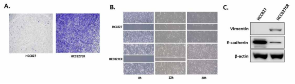 Transwell migration assay (A) 와 wound-healing assay를 통해 EGFR TKI 내성을 가진 폐암세포의 migration이 증가함을 발견함. (C) EMT 마커의 western blotting 을 통해 EGFR TKI 내성 폐암세포의 EMT 표현형을 확인함