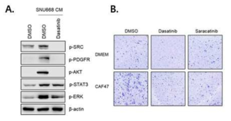 위암 세포 conditioned medium (CM)에 의하여 유도되는 CAF 내 세포신호전달 단백질 활성화 (A) 및 CAF에 의한 위암세포이동성 증가를 dasainib이 억제 함을 발견함