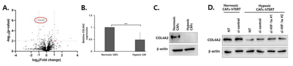 A. LC-MS 기반 secretome 분석을 통해 저산소 CAF 특이적 differentially expressed protein (DEP) 프로파일링. 이 중 종양미세환경 조절자로 기능이 보고된 COL4A2에 초점을 맞추어 연구를 진행함. B and C. RT-PCR (B)과 Western blot (C) 으로 저산소 환경에 노출된 CAF에서 COL4A2 발현이 감소함을 규명함. D. 저산소 CAF의 COL4A2의 발현 변화가 HIF-1α 와 무관하게 일어남을 규명함