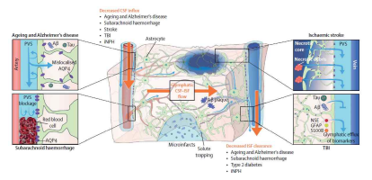 글림파틱 시스템 (glymphatic system)의 모식도. 거미막밑 공간의 뇌척수액이 뇌동맥혈관 주변 공간 (periarterial space)을 따라 뇌실질로 유입되는 CSF influx, 뇌실질에서 간질액과 섞이면서 대사노폐물을 운반하는 CSF-ISF flow, 뇌정맥혈관 주변 공간 (perivenous space)을 따라 배출되는 ISF efflux 단계로 구성됨 (Rasmussen et al., 2018)