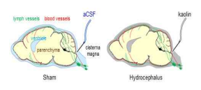 Wistar rat 대수조 (cisterna magna)에 kaolin 주입하여 뇌척수액 순환장애 동물모델을 만드는 모식도. Kaolin (10%, 60ul, MW 258.16) 주입 이후, 뇌 기저부와 측면으로 점차적 kaolin 침착되어, 뇌척수액 흐름과 흡수를 막아, 뇌척수액 순환장애 동물모델을 제작함