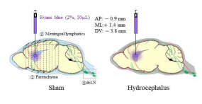 뇌척수액 순환장애 모델 제작 8주 후, 대뇌 내 글림파틱-뇌수막 림프계와 두 개외 경부림프절 신호 전달 체계 특징을 규명하기 위해 시간 (3시간, 24시간)에 따라 측뇌실(ventricle)에 주입된 Evans blue (EB) dye 염색 정도를 ① brain parenchyma, ② meningeal lymphatics, ③ dcLN 포인트들을 중점으로 평가함