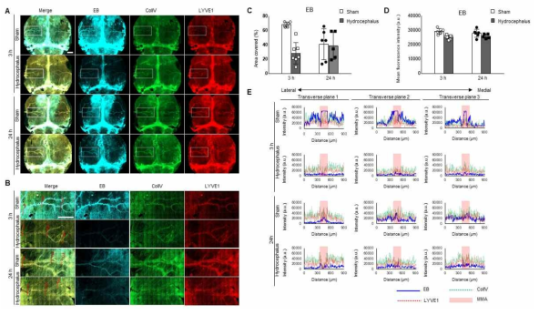 뇌척수액 순환장애 모델 제작 8주 후, 글림파틱-뇌수막 림프계의 상호 연관성 평가하기 위해 시간 (3 시간, 24시간)에 따라 뇌수막에서 측뇌실에 주입된 EB 염료의 확산 정도를 관찰함 (Sham 3h, n=6; Sham 24h, n=7; Hydrocephalus 3h, n=6; Hydrocephalus 24h, n=5). 뇌수막을 두개골에서 완전히 분리하여, 면역 염색을 통해 뇌수막에 분포되어 있는 혈관 (ColIV) 및 림프혈관 (LEVY1)을 시각화 함. 면역 염색을 통해 시각화된 중경막동맥 (middle meningeal artery: MMA)을 기준으로 뇌척수액 순환장애 모델에서 EB의 확산 정도가 지체됨을 관찰함. 뇌 안에 글림파틱 시스템에 손상이 되었을 때 뇌수막 림프계 기능이 감소됨을 규명함