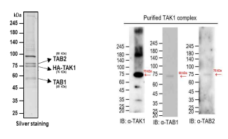 HEK293T 세포에서 정제한 HA-TAK1/endoTAB1/endoTAB2 complex의 silver staining (좌) 및 immunoblot (우) 결과