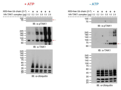 K63-linked poly-ubiquitin free chain에 의한 TAK1의 인산화를 ATP 존재 시 (좌)와 ATP가 부존재시 (우) 비교한 immunoblot 결과
