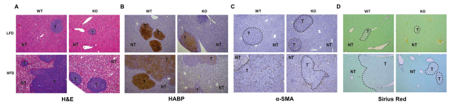 (A) H&E염색, (B) 히알루론산 염색, (C) α-SMA 염색, (D) 콜라겐 염색