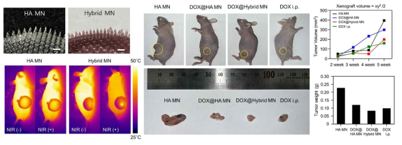필름형 플라즈몬 미세바늘 패치의 빛 감응성 입증 및 생쥐를 이용한 생체 내 실험 효과