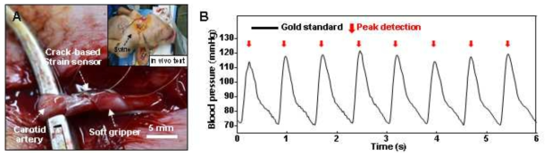 초소형 소프트 그리퍼 기계적 성능 평가. (A) 돼지 혈관을 잡은 그리퍼, (B) 그리퍼에 잡힌 혈관 부에서 측정되는 돼지의 생체 신호