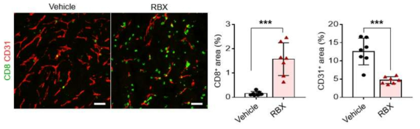 RBX에 의한 종양내 암혈관과 T세포 면역의 변화