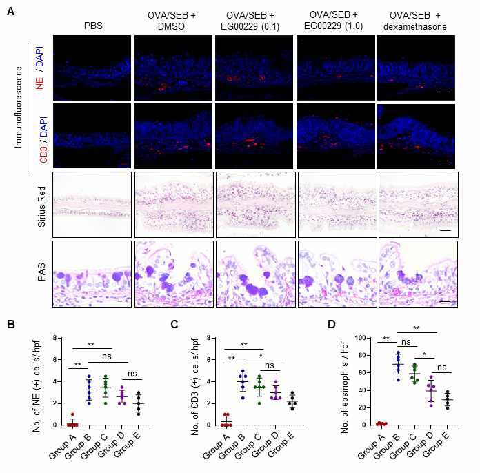 NRP1 inhibitor (EG00229)처리에 따른 염증 반응 확인