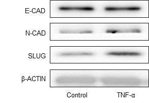TNF-α 처리를 통한 EMT 관련 단백질 발현 분석