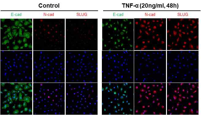 Immunocytochemistry 기법을 통한 TNF-α 처리 시 EMT 관련 단백질 발현 양상 분석