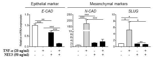 NEU3를 이용한 GD3 억제 후, TNF-α 처리에 따른 EMT 반응 비교