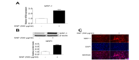 섬유아세포에 SNP처리에 따른 NRP1 발현 변화 분석
