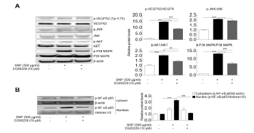 NRP1 발현 억제 후, SNP 처리에 따른 signal pathway 변화 분석