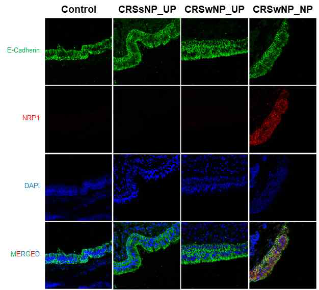 비용조직에서 E-Cadherin과 NRP1의 발현