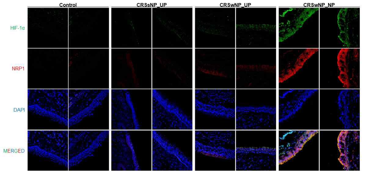 비용조직에서 HIF-1α 및 NRP1의 발현