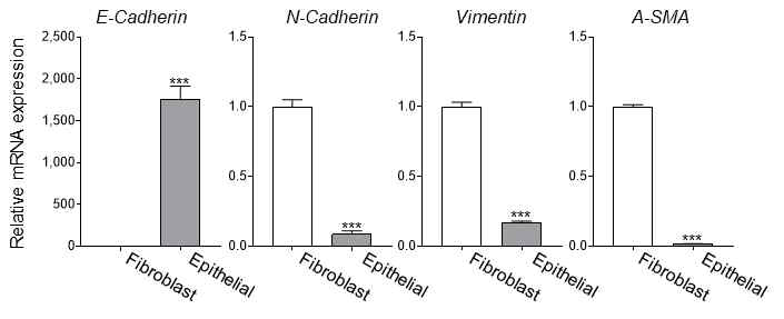 mRNA 수준에서 epithelial cell의 특성 분석