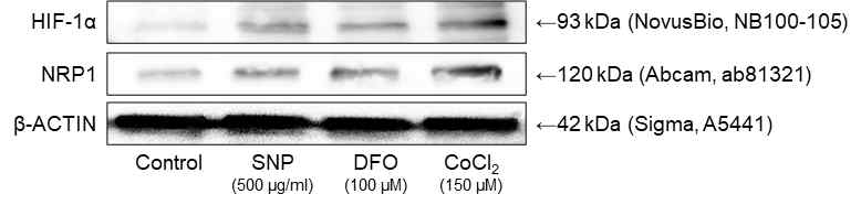 Hypoxia에 따른 HIF-1α 및 NRP1 발현 비교