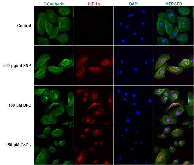 형광염색을 통한 Hypoxia에 따른 HIF-1α 발현 비교