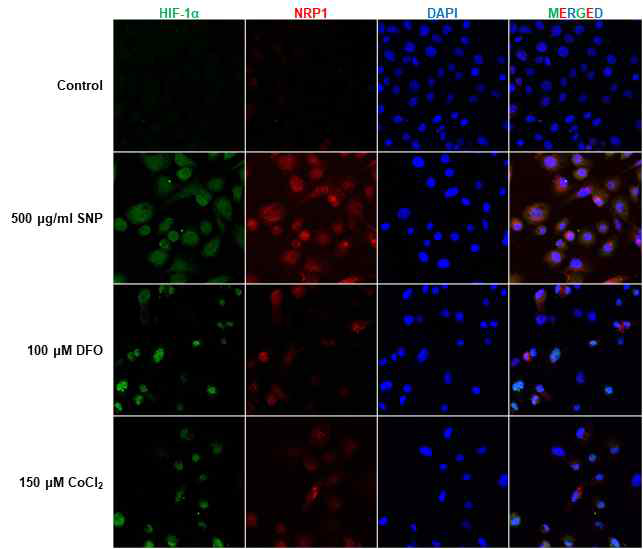 형광염색을 통한 Hypoxia에 따른 HIF-1α 및 NRP1 발현 비교