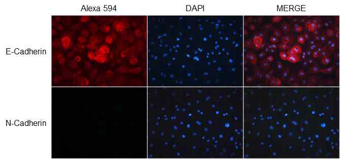 protein 수준에서 epithelial cell의 특성 분석