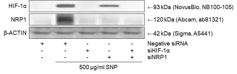 HIF-1α 및 NRP1 억제에 따른 HIF-1α 및 NRP1 발현 비교