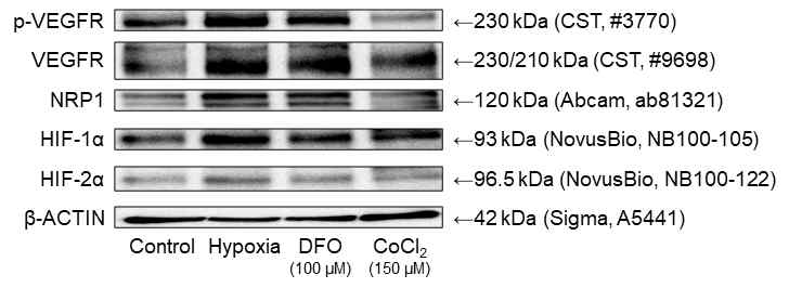 Hypoxia에 따른 VEGFR, NRP1, HIF-1α 및 HIF-2α 발현 비교