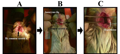 TBI 동물 모델 제작 과정. 총경동맥의 분리(A), 결찰(B) 및 재관류(C)