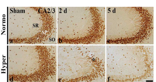 고체온 유발에 따른 해마 CA2/3영역에서 신경세포 사멸 악화