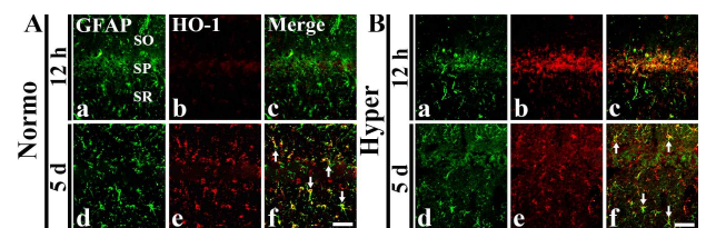 TBI 모델에서 고체온 유발에 따른 해마 CA1 및 CA2/3영역에서 HO-1 발현 변화