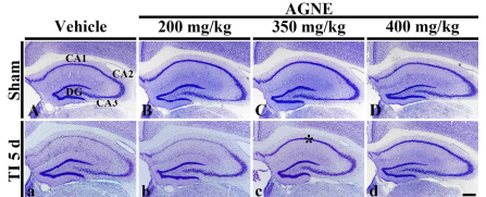 TBI 모델에서 고체온 유발에 따른 해마 CA1 및 CA2/3영역에서 HO-1 발현 변화