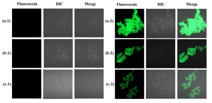 Confocal microscopy images of (a) Control 1, (b) FE (c) Control 2 (d) FB, (e) Control 3, (f) FT samples