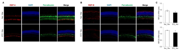 Streptozotocin 주사 후 16주 차 당뇨 랫트 망막 내 RBP의 발현 변화